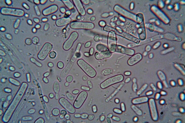 Prevención de Legionella Industrial: Guía Completa para Empresas